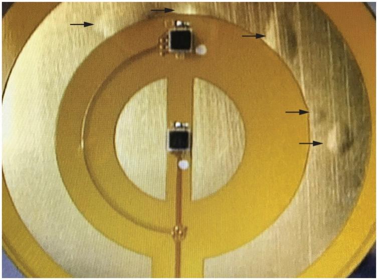 图14.CBT贴片的刚柔结合PCB分层。 图14.CBT贴片的刚柔结合PCB分层。